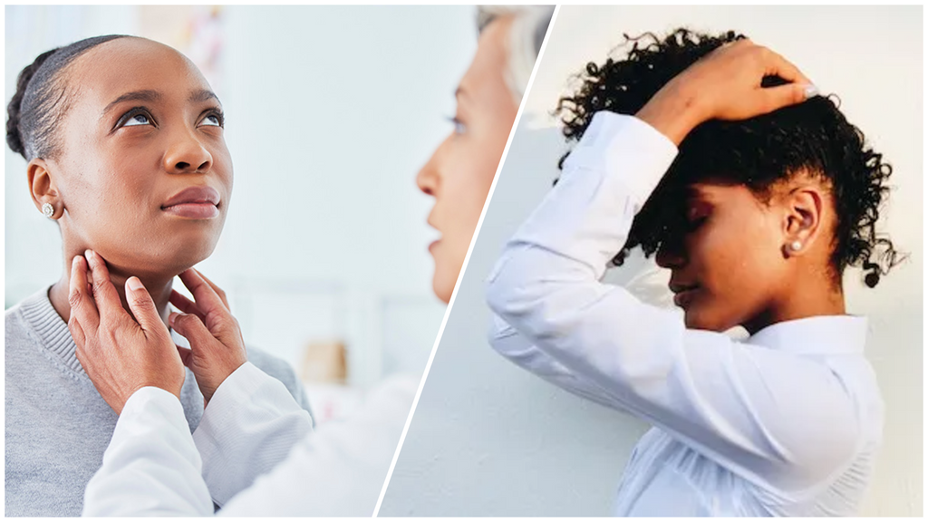 Thyroid Hair Loss