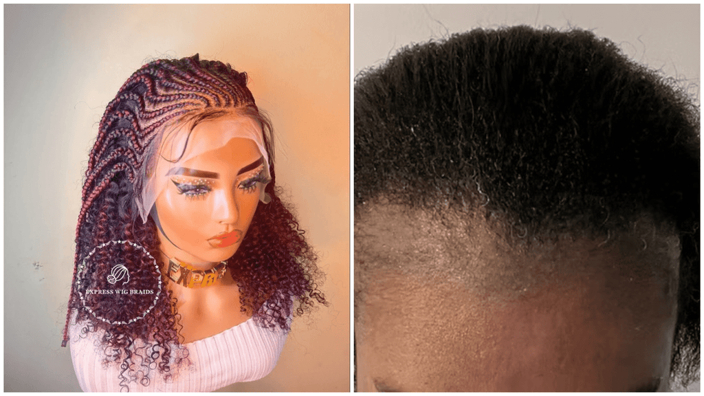 How Protective Braided Wigs Can Prevent Traction Alopecia