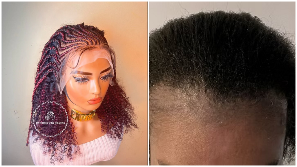 How Protective Braided Wigs Can Prevent Traction Alopecia