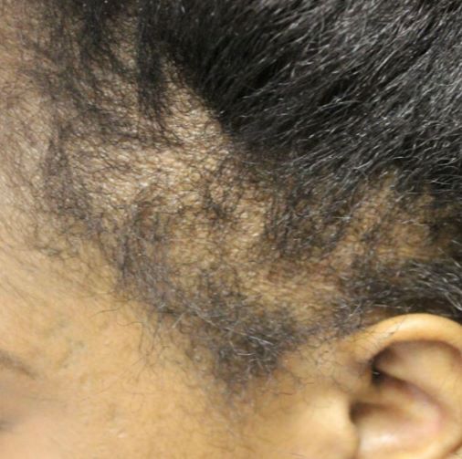 Common Hair Problems and Solutions