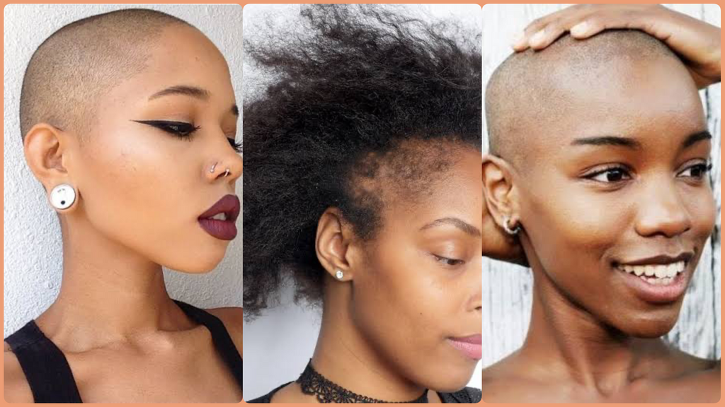 Embracing Your Natural Beauty Through Hair Loss: Inspiring Stories from People