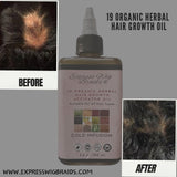 Organic 19 Herbal Hair Growth Activator Oil - Express Wig Braids